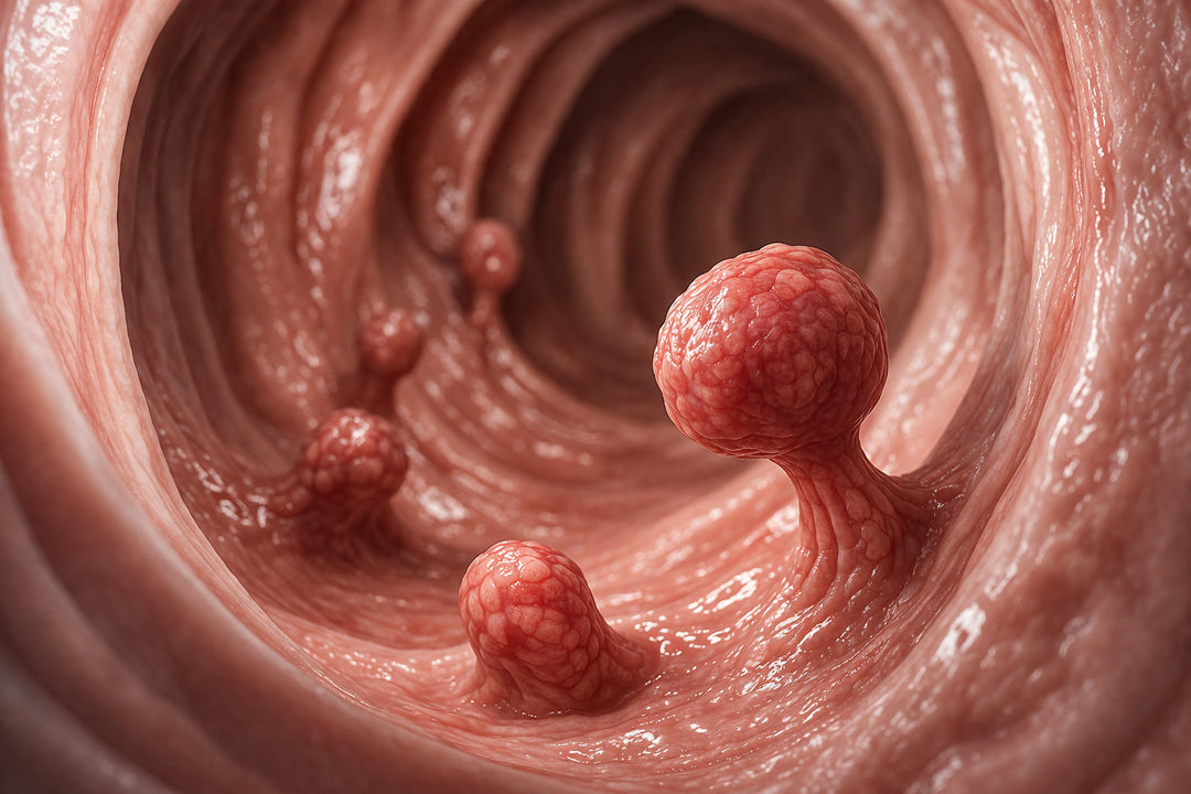 Bowel cancer symptoms and screening